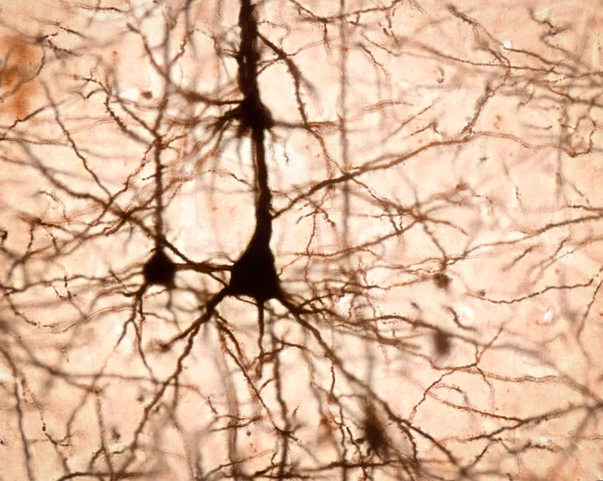 New Neuroplasticity Mechanism Discovered: Brain Rewires After Single Experience