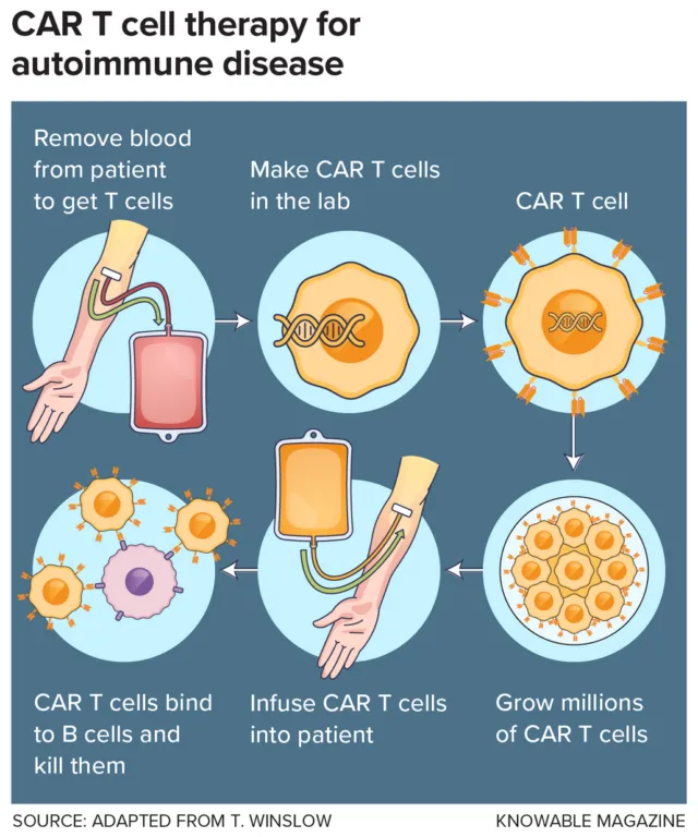 CAR T-Cell Therapy Shows Promise for Autoimmune Diseases Beyond Cancer