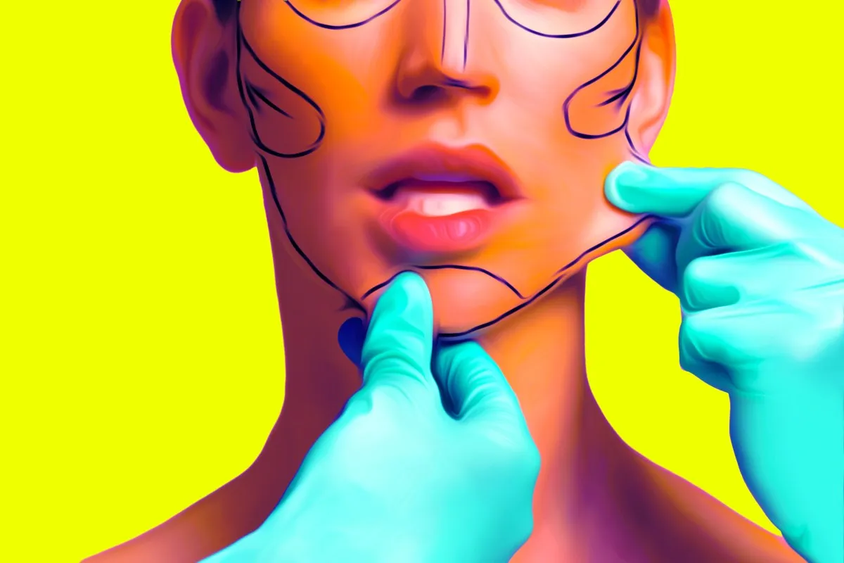 AI's Unsettling Influence: Patients Seek 'Bratz Doll' Aesthetics in Plastic Surgery