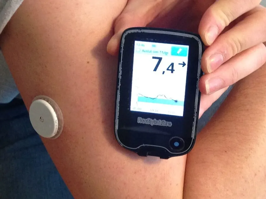 Beyond Diabetes: Continuous Glucose Monitors Enter the Mainstream Wellness Market