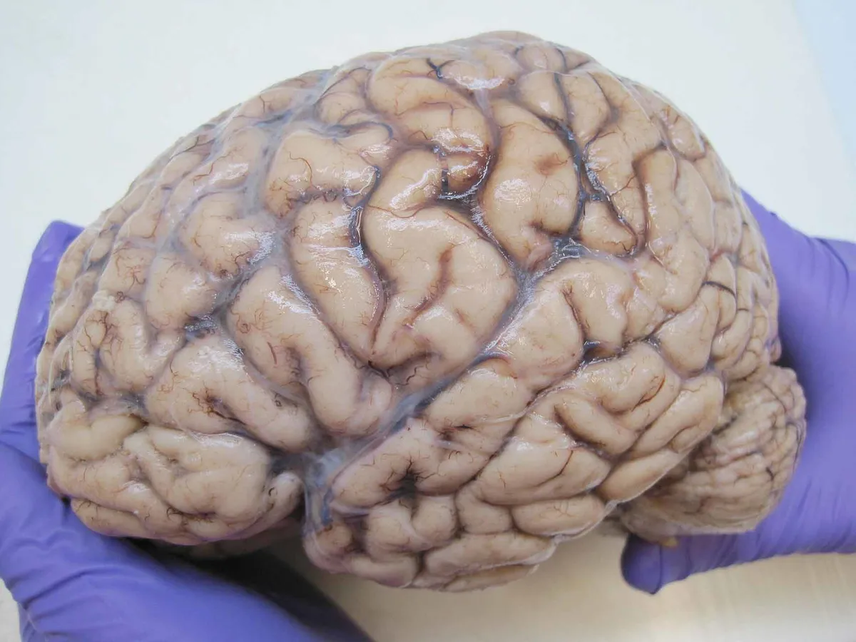 Startup Bexorg Pioneers Drug Testing Using Preserved Human Brains