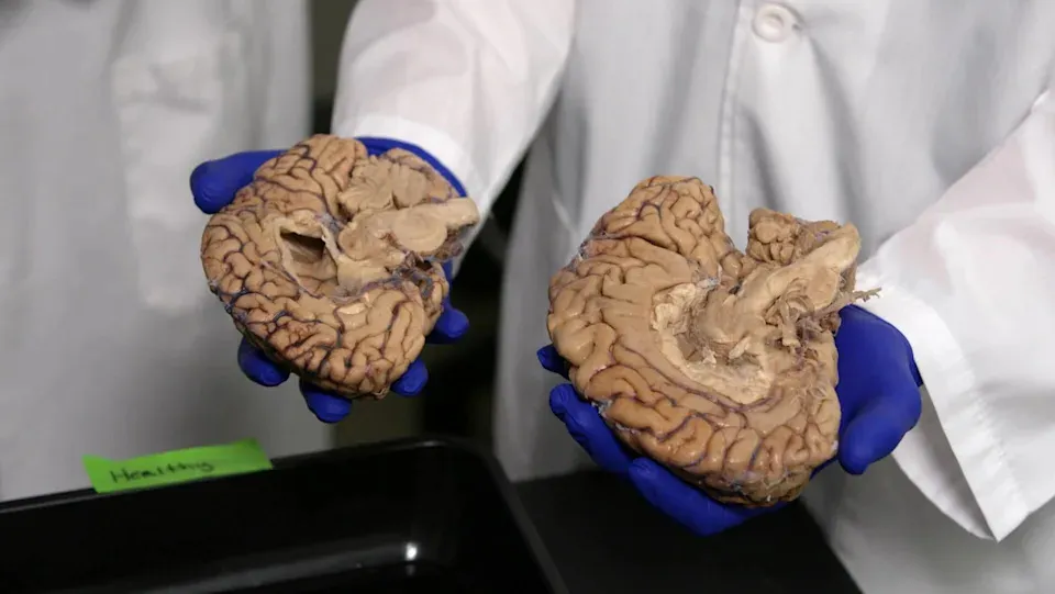 Ralph the Dog's Journey Illuminates Canine Cognitive Decline and Aging Research